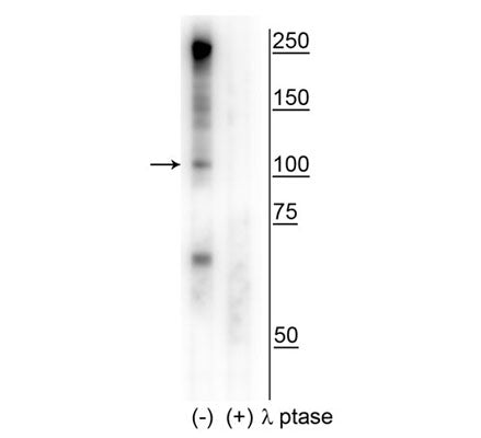 Western blot of human T47D cell lysate showing specific immunolabeling of the ~100 kDa CtIP phosphorylated at Ser327 in the first lane (-). Phosphospecificity is shown in the second lane (+) where immunolabeling is completely eliminated by blot treatment with lambda phosphatase (λ-Ptase, 1200 units for 30 min).