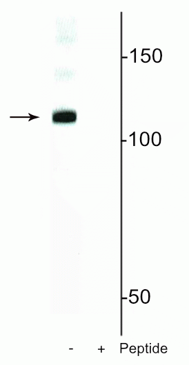 Western blot of mouse nuclei lysate showing specific immunolabeling of the ~120 kDa DGCR8 protein phosphorylated at in the first lane (-). Phosphospecificity is shown in the second lane (+) where immunolabeling is blocked by preadsorption of the phosphopeptide used as the antigen, but not by the corresponding non-phosphopeptide (not shown). 