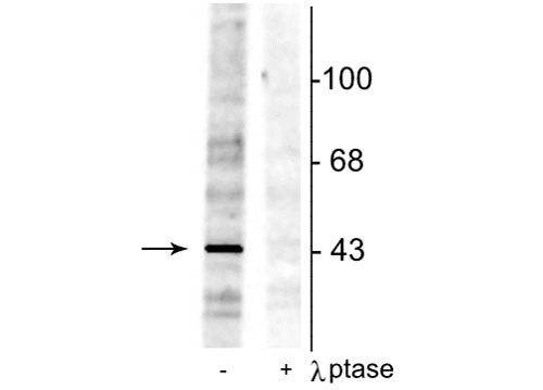 Western blot of rat testes lysate showing specific immunolabeling of the ~46 kDa EphrinB phosphorylated at Tyr298 in the first lane (-). Phosphospecificity is shown in the second lane (+) where immunolabeling is completely eliminated by blot treatment with lambda phosphatase (λ-Ptase, 1200 units for 30 min).