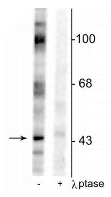 Western blot of rat testes lysate showing specific immunolabeling of the ~46 kDa EphrinB phosphorylated at Tyr317 in the first lane (-). Phosphospecificity is shown in the second lane (+) where immunolabeling is completely eliminated by blot treatment with lambda phosphatase (λ-Ptase, 1200 units for 30 min).