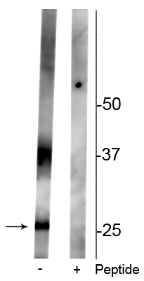 Anti-Aquaporin 2 (Ser261) Antibody | p112-261