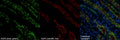 Immunolabeling of vasopressin treated mouse kidney (inner medulla) showing specific labeling of the AQP2 protein phosphorylated at Ser269 (Cat. p112-269, red, 1:1000) and total AQP2 (green). Nuclei labeled with DAPI. Magnification 600x. Image kindly provided by Juan Pablo Arroyo Ornelas,
