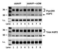 Western analysis of rat kidney inner medullary (IM) lysate from ddAVP and ddAVP + ADM-treated IM probed for total (bottom) and pSer269 (Cat. p112-269, 1:1000)(top) AQP2. Brackets indicate the glycosylated AQP2 protein between 35 and 45 kDa, and the arrow indicates the un glycosylated