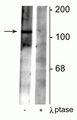 Western blot of rat synaptic membrane lysate showing specific immunolabeling of the ~102 kDa GABAB R2 protein phosphorylated at Ser783 in the first lane (-). Phosphospecificity is shown in the second lane (+) where immunolabeling is completely eliminated by blot treatment with lambda phosphatase (λ-Ptase, 1200 units for 30 min). 