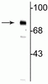 Western blot of neonatal rat brain showing specific immunolabeling of the ~75 kDa MeCP2 protein phosphorylated at Ser80.