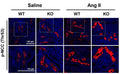 Immunolabeling of mouse kidney paraffin section specifically detecting NCC Thr53 (Cat. p1311-53, red, 1:1000) phosphorylation with the increased NCC activation in Ang-II-infused Prdx5 KO kidney. Image from publication, CC-BY-4.0. PMID: