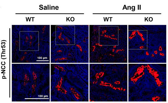 Immunolabeling of mouse kidney paraffin section specifically detecting NCC Thr53 (Cat no p1311-53, red, 1:1000) phosphorylation with the increased NCC activation in Ang-II-infused Prdx5 KO kidney. Image from publication, CC-BY-4.0. PMID: 39857434.