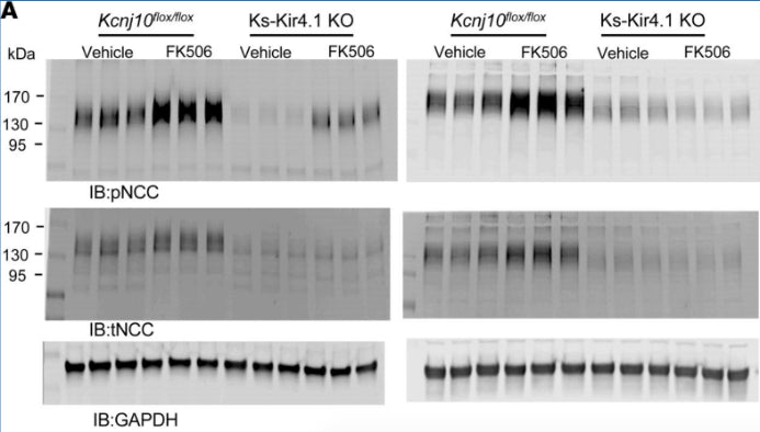 Two Western blots show the abundance of pNCCT53 (cat. p1311-53, 1:200) and tNCC in male Kcnj10fl/fl mice and in Ks-Kir4.1–KO mice treated with vehicle (control) and FK506 (0.75 mg/kg BW). Image from publication CC-BY-4.0. PMID: 36821372