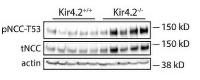 Western blot image of kidney measuring levels of pNCC-T53 and total NCC in Kir4.2+/+ and Kir4.2−/− mice. Image from publication, CC-BY-4.0. PMID: 38886379.