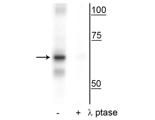 Western blot of 20’ UV treated HeLa lysate showing specific immunolabeling of the ~65 kDa NF-κB p65 phosphorylated at Ser316 in the first lane (-). Phosphospecificity is shown in the second lane (+) where immunolabeling is eliminated by blot treatment with lambda phosphatase (lambda-Ptase, 1200 units for 30 min).