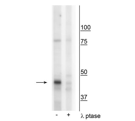 Western blot of mouse mitochondria from whole brain lysate showing specific immunolabeling of the ~46 kDa CK1Mt protein phosphorylated at Tyr153 in the first lane (-). Phosphospecificity is shown in the second lane (+) where the immunolabeling is greatly decreased by blot treatment with lambda phosphatase (λ-Ptase, 1200 units for 30 minutes).