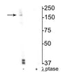 Western blot of mouse hippocampal lysate showing specific immunolabeling of the ~180 kDa NR2B subunit of the NMDAR phosphorylated at Ser1166 in the first lane (-). Phosphospecificity is shown in the second lane (+) where immunolabeling is completely eliminated by lysate treatment with lambda phosphatase (1200 units/100uL lysate overnight).