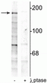 Western blot of rat hippocampal lysate showing specific immunolabeling of the ~180 kDa NR2B subunit phosphorylated at Tyr1252 in the first lane (-). Phosphospecificity is shown in the second lane (+) where immunolabeling is completely eliminated by blot treatment with lambda phosphatase (λ-Ptase, 1200 units for 30 min).