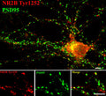 Immunostaining of 14 DIV rat cortical neurons showing NR2B phosphorylated at Tyr1252 (red, 1:400) and PSD95 (green). Photo courtesy of Gang Liu.