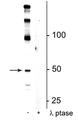 Western blot of mouse hippocampal lysate showing specific immunolabeling of the ~50 kDa eEF1A2 protein phosphorylated at Ser358 in the first lane (-). Phosphospecificity is shown in the second lane (+) where immunolabeling is completely eliminated by lysate treatment with lambda phosphatase (λ-Ptase, 800 units/1mg protein for 30 min). 
