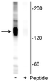 Western blot of rat hippocampal lysate showing specific labeling of the ~135 kDa KCC2 protein phosphorylated at Ser940 in the first lane (-). Immunolabeling is blocked by preadsorption with the phosphopeptide used as antigen in the second lane (+), but not by the corresponding non-phosphopeptide (not shown).