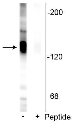 Western blot of rat hippocampal lysate showing specific labeling of the ~135 kDa KCC2 protein phosphorylated at Ser940 in the first lane (-). Immunolabeling is blocked by preadsorption with the phosphopeptide used as antigen in the second lane (+), but not by the corresponding non-phosphopeptide (not shown).