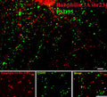 Immunostaining of 14 DIV rat cortical neurons labeling rabphilin when phosphorylated at Ser234 (Cat. p1553-234, red, 1:400) and PSD95 (green). The rat cortical neurons were fixed with methanol at -20C for 10 minutes. Photo courtesy