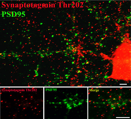 Immunostaining of 14 DIV rat cortical neurons labeling synaptotagmin when phosphorylated at Thr202 (cat. p1570-202, 1:400, red) and PSD95 (green). The cortical neurons were fixed with methanol at -20C for 10 minutes. Photo courtesy of Gang Liu.