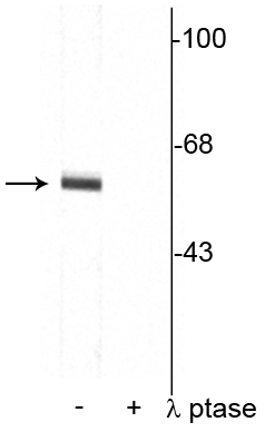 Western blot of rat cortical lysate showing specific immunolabeling of the ~62 kDa synaptotagmin phosphorylated at Thr202 in the first lane (-). Phosphospecificity is shown in the second lane (+) where the immunolabeling is completely eliminated by blot treatment with lambda phosphatase (λ-Ptase, 1200 units for 30 minutes). 
