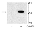 Western blot of recombinant tryptophan hydroxylase incubated in the absence (-) and presence (+) of Ca2+/calmodulin dependent kinase II showing specific immunolabeling of the ~55 kDa tryptophan hydroxylase protein phosphorylated at Ser19.