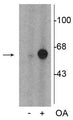Western blot of PC-12 cell lysate incubated in the absence (-) and presence (+) of okadaic acid (OA, 1 µM for 60 min) showing specific immunolabeling of the ~60 kDa tyrosine hydroxylase phosphorylated at Ser31. 