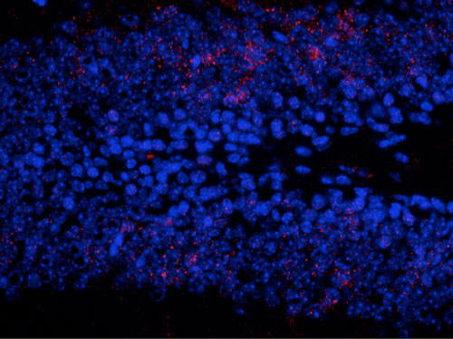 Immunostaining of granule cells in the dentate gyrus of the hippocampus from saline treated mouse brain staining ERK/MAPK when phosphorylated at Thr202/Tyr204 (cat. p160-2024, 1:500, red). The blue is staining nuclei with DAPI. The MAPK positive neurons show punctate staining primarily localized in the nucleus with few staining both cytoplasmic and nuclear. Photo courtesy of Robert Wine.