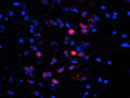 Immunostaining of neurons in the frontal cortex of saline treated mouse brain identifying cytoplasmic and nuclear staining of ERK/MAPK when phosphorylated at Thr202/Tyr204 (Cat. p160-2024, red, 1:500). The intense nuclear staining of a few neurons shows stimulation of the neuron resulting in translocation of the