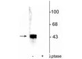 Western blot of human T47D cell lysate showing specific immunolabeling of ~42-44 kDa ERK/MAPK protein phosphorylated at Thr202/Tyr204 in the first lane (-). Phosphospecificity is shown in the second lane (+) where immunolabeling is completely eliminated by blot treatment with lambda phosphatase (λ-Ptase, 1200 units for 30 min).