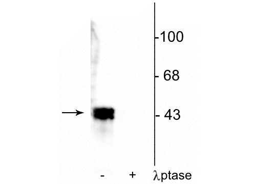 Western blot of human T47D cell lysate showing specific immunolabeling of ~42-44 kDa ERK/MAPK protein phosphorylated at Thr202/Tyr204 in the first lane (-). Phosphospecificity is shown in the second lane (+) where immunolabeling is completely eliminated by blot treatment with lambda phosphatase (λ-Ptase, 1200 units for 30 min).
