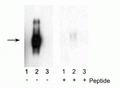 Western blot of immunoprecipitates from HEK 293 cells transfected with 1) Mock, 2) IFNAR1 WT, and 3) IFNAR1 S535A and S539A mutants. Specific immunolabeling of the ~110 kDa to ~130 kDa IFNAR1 WT (2) is shown in the first blot, as the immunolabeling is absent in IFNAR1 Ser535 and Ser539 mutants (3). The specific immunolabeling is blocked by the phosphopeptide (+) used as the antigen in the second blot.