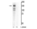 Western blot of HEK293 lysate showing specific immunolabeling of the ~160 kDa MerTK phosphorylated at Tyr749/753/754 in the first lane (-). Phosphospecificity is shown in the second lane (+) where the immunolabeling is completely eliminated by blot treatment with lambda phosphatase (λ-Ptase, 1200 units for 60 minutes).