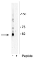 Western blot of Jurkat cell lysate showing specific immunolabeling of the ~62 kDa p62 phosphorylated at Thr269/Ser272 in the first lane (-). Phosphospecificity is shown in the second lane (+) where immunolabeling is blocked by preadsorption of the phosphopeptide used as antigen, but not by the corresponding non-phosphopeptide (not shown). 