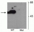 Western blot of HEK293 cells transfected with Parkin wild type (WT) and Parkin S101 mutant (Mut) showing the specific immunolabeling of the ~52 kDa parkin protein phosphorylated at Ser101. 