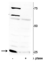 Western blot of mouse heart lysate showing specific immunolabeling of ~25 kDa cardiac troponin I protein phosphorylated at Ser150 in the first lane (-). Phosphospecificity is shown in the second lane (+) where the immunolabeling is completely greatly decreased by blot treatment with lambda phosphatase (λ-Ptase, 1200 units for 30 minutes). 