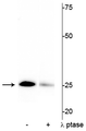 Western blot of mouse heart lysate showing specific immunolabeling of the ~25 kDa cardiac troponin I protein phosphorylated at Ser43 in the first lane (-). Phosphospecificity is shown in the second lane (+) where the immunolabeling is greatly decreased by blot treatment with lambda phosphatase (λ-Ptase, 1200 units for 30 minutes). 