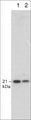 Western blot analysis of p21 expression in human endothelial cells (lanes 1 & 2). The blots were probed with mouse monoclonal anti-p21 at 1:250 (lane 1) and 1:1000 (lane 2).