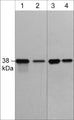 Western blot analysis of human A431 cells (lanes 1 & 2) and rat A7r5 cells (lanes 3 & 4). The blot was probed with mouse monoclonal anti-p38α (C-terminal) clone M548 at a dilution of 1:250 (lanes 1 & 3) or 1:1000 (lanes 2 & 4).