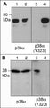 A) Western blot image of GST-recombinant p38 (K53M) mutant kinase untreated (lanes 1 & 3) or treated with Fyn kinase (lanes 2 & 4). B) Western blot analysis of p38 phosphorylation in mouse macrophages stimulated with 1 mM pervanadate for 30 min. (lanes 1 & 3) then the blot was treated with alkaline phosphatase (lanes 2 & 4). Both blots were probed with anti-p38α (a.a. 319-328) (lanes 1 & 2) or anti-p38α (Tyr-323) (lanes 3 & 4).