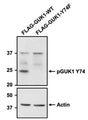 Western blot detection of GUK1 phosphorylated at Tyr74 using anti-pGUK1 Tyr74 rabbit polyclonal antibody (Cat No. pGUK1-74 ). Whole cell lysates were generated from HEK293T cells stably co-expressing EML4-ALK fusion protein with FLAG-GUK1-WT or FLAG-GUK1-Y74F mutant, run on SDS-PAGE gel, transferred to a nitrocellulose membrane and examined by Western blot. The blot was probed with pGUK1-Y74 primary antibody at a concentration of 1:200 and then detected via chemiluminescence using a Goat Anti-Rabbit H+L, HRP conjugated secondary antibody. Actin was used as a loading control to show equal loading of both lysates. pGUK1 Y74 antibody recognizes only GUK1-WT and not the phospho-deficient mutant GUK1-Y74F at the expected molecular weight of ~25 kDa. Image courtesy of Kiran Kurmi, University of Miami Miller School of Medicine.