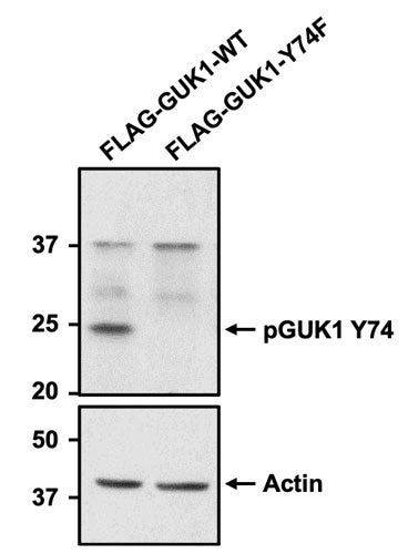 Western blot detection of GUK1 phosphorylated at Tyr74 using anti-pGUK1 Tyr74 rabbit polyclonal antibody (Cat No. pGUK1-74 ). Whole cell lysates were generated from HEK293T cells stably co-expressing EML4-ALK fusion protein with FLAG-GUK1-WT or FLAG-GUK1-Y74F mutant, run on SDS-PAGE gel, transferred to a nitrocellulose membrane and examined by Western blot. The blot was probed with pGUK1-Y74 primary antibody at a concentration of 1:200 and then detected via chemiluminescence using a Goat Anti-Rabbit H+L, HRP conjugated secondary antibody. Actin was used as a loading control to show equal loading of both lysates. pGUK1 Y74 antibody recognizes only GUK1-WT and not the phospho-deficient mutant GUK1-Y74F at the expected molecular weight of ~25 kDa. Image courtesy of Kiran Kurmi, University of Miami Miller School of Medicine.