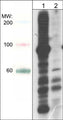 Western blot analysis of A431 cells treated with calyculin A (100 nM) for 30 min (lane 1) then treated with lambda phosphatase (lane 2). The blot was probed with anti-Phosphoserine/threonine rabbit polyclonal at 1:1000.