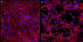 NGF-induced differentiation of PC12 cells in culture. PC12 cells were plated on poly-lysine-coated coverslips and treated with 75 ng/mL native mouse NGF for 19 days. Cells start to differentiate after 6 days, forming a dense neurite network. Images were taken with a light microscope at 10X magnification.