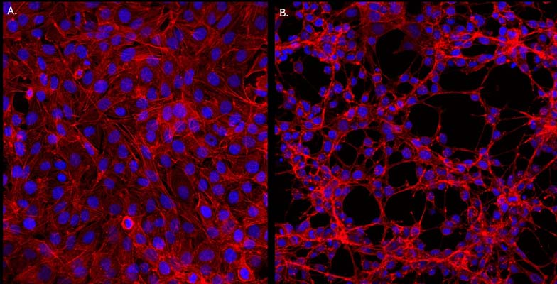NGF-induced differentiation of PC12 cells in culture. PC12 cells were plated on poly-lysine-coated coverslips and treated with 75 ng/mL native mouse NGF for 19 days. Cells start to differentiate after 6 days, forming a dense neurite network. Images were taken with a light microscope at 10X magnification.