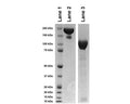 Gel analysis of TrkA-Fc Chimera. Lane 1: MW markerLane 2: TrkA-Fc Chimera (20 µg), non-reducingLane 3: TrkA-Fc Chimera (20 µg), reducing condition