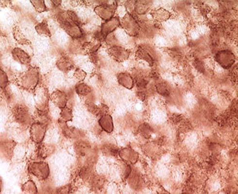 Immunohistochemical staining of pan synuclein in rat cochlear nucleus using rabbit polyclonal antibody to human pan synuclein, catalogue number R-060-100.
