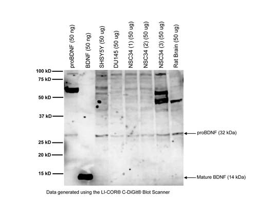 Western blot analysis of BDNF expression in cell lysates and brain homogenate. Polyclonal rabbit BDNF antibody to BDNF (129-138) detects proBDNF at 32 kDa in samples. Additional uncharacterized bands are observed at higher molecular weights. Western Blotting Method: SDS-PAGE: denaturing and reducing, 12% Bis-Tris gel; Transfer: Tris-Glycine buffer, semi-dry transfer; Membrane: nitrocellulose (0.22 um); Blocking: 5% skim milk in TBST, 1 hour at RT; Primary antibody: 10 µg/mL, overnight at 4C; Secondary antibody: anti-rabbit-HRP (1/5000), 1 hour at RT; Detection: Chemiluminiscence