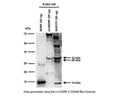 Western blot analysis of BDNF expression in SH-SY5Y cell lysate. Polyclonal rabbit BDNF antibody to BDNF (129-138; here whole serum antibody R-083-100 at 1:1000 dilution is shown) detects monomeric BDNF at 14 kDa and monomeric proBDNF at 32 kDa. An additional 28 kDa band is prominent which might relate to BDNF dimer or truncated BDNF isoform (Tongiorgi et al., 2012). Western Blotting Method: SDS-PAGE: denaturing and reducing, 12% Bis-Tris gel; Transfer: Tris-Glycine buffer, semi-dry transfer; Membrane: nitrocellulose (0.22 um); Blocking: 5% skim milk in TBST, 1 hour at RT; Primary antibody: overnight at 4C; Secondary antibody: anti-rabbit-HRP (1/6000), 2 hours at RT; Detection: Chemiluminiscence.