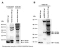 Western blot analysis of BDNF expression in human serum (A) and human brain (B). Polyclonal rabbit BDNF antibody to BDNF (129-138; here whole serum antibody R-083-100 at 1:1000 dilution is shown) detects monomeric BDNF at 14 kDa in both samples, as well as monomeric proBDNF at 32 kDa in human brain (B). In addition, a 18 kDa BDNF isoform is detected in human serum (A), confirmed with a monoclonal mouse antibody to rhBDNF, Clone 4C8 (M-1744-50/100, 1 µg/mL). A 18 kDa BDNF-isoform has previously been detected with other BDNF antibodies ( Tongiorgi et al., 2012 ;  Silhol et al., 2007 ). In human brain (B), a 28 kDa band is prominent which might relate to BDNF dimer or truncated BDNF isoform ( Tongiorgi et al., 2012 ). Western Blotting Method: SDS-PAGE: denaturing and reducing, 12% Bis-Tris gel; Transfer: Tris-Glycine buffer, semi-dry transfer; Membrane: nitrocellulose (0.22 um); Blocking: 5% skim milk in TBST, 1 hour at RT; Primary antibody: overnight at 4C; Secondary antibody: anti-mouse-HRP or anti-rabbit-HRP (1/6000), 2 hours at RT; Detection: Chemiluminiscence.
