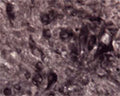 IHC on rat spinal cord (free floating cryo section) using Rabbit antibody to human APP: whole serum (R-070-100) at a dilution of 1: 1000.